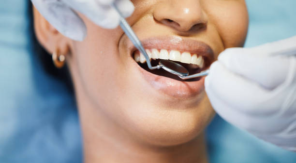 Best After-Hours Emergency Dentist in Cordele, GA