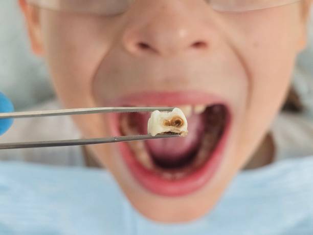 Best Emergency Dental Care for Trauma or Injury in Cordele, GA